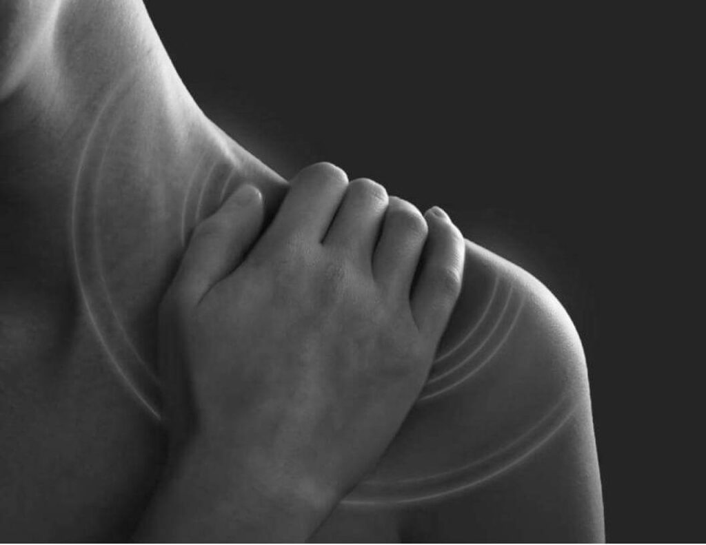 Shoulder Impingement: What is it and How Do You Get Rid of it?