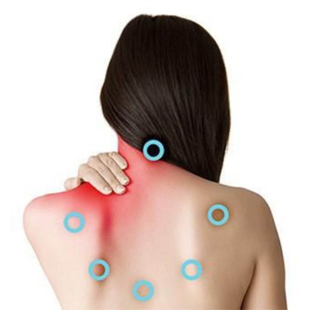 Trigger Point Injections at ProClinix