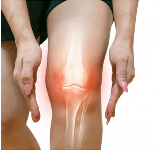 What You Should Know About Meniscus and ACL Injuries